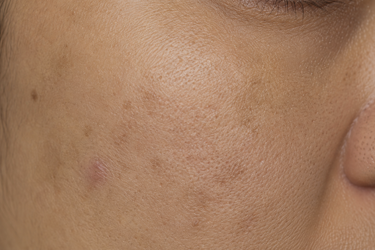 Dark Spots